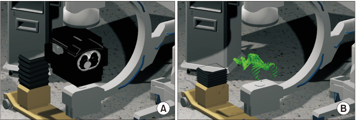 Development of pre-procedure virtual simulation for challenging interventional procedures: an experimental study with clinical application.