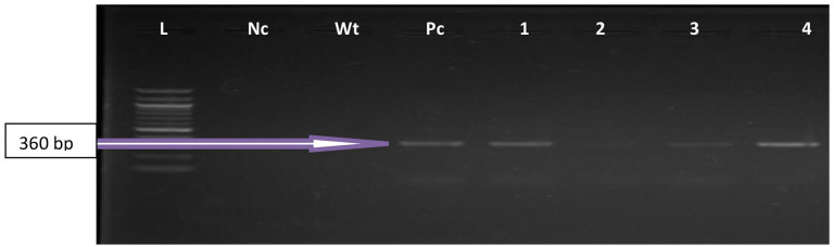 Occurrence of New Delhi Metallo-Beta-Lactamase 1 Producing <i>Enterococcus</i> Species in Oghara Water Nexus: An Emerging Environmental Implications of Resistance Dynamics.