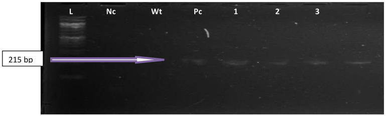 Occurrence of New Delhi Metallo-Beta-Lactamase 1 Producing <i>Enterococcus</i> Species in Oghara Water Nexus: An Emerging Environmental Implications of Resistance Dynamics.