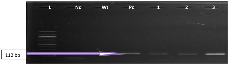 Occurrence of New Delhi Metallo-Beta-Lactamase 1 Producing <i>Enterococcus</i> Species in Oghara Water Nexus: An Emerging Environmental Implications of Resistance Dynamics.