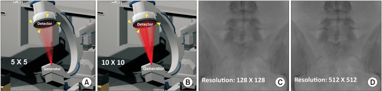 Development of pre-procedure virtual simulation for challenging interventional procedures: an experimental study with clinical application.