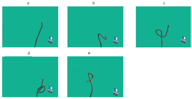 Investigation of the New Advantages of Colonoscope Insertion with an Endoscopic Position Detection Unit.