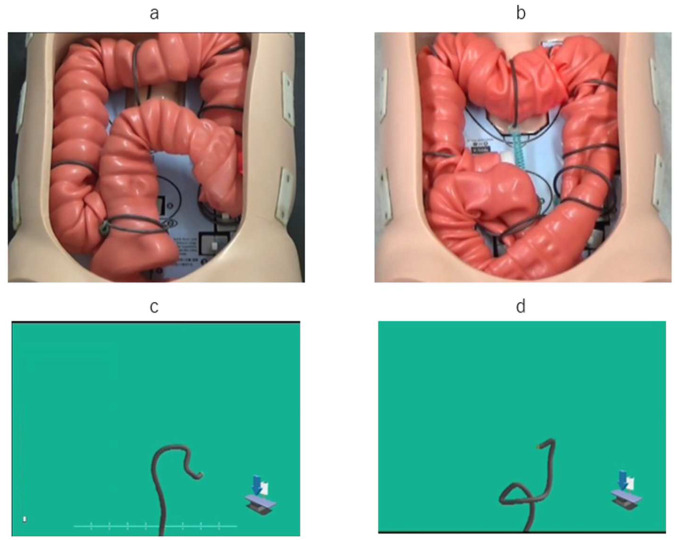Investigation of the New Advantages of Colonoscope Insertion with an Endoscopic Position Detection Unit.