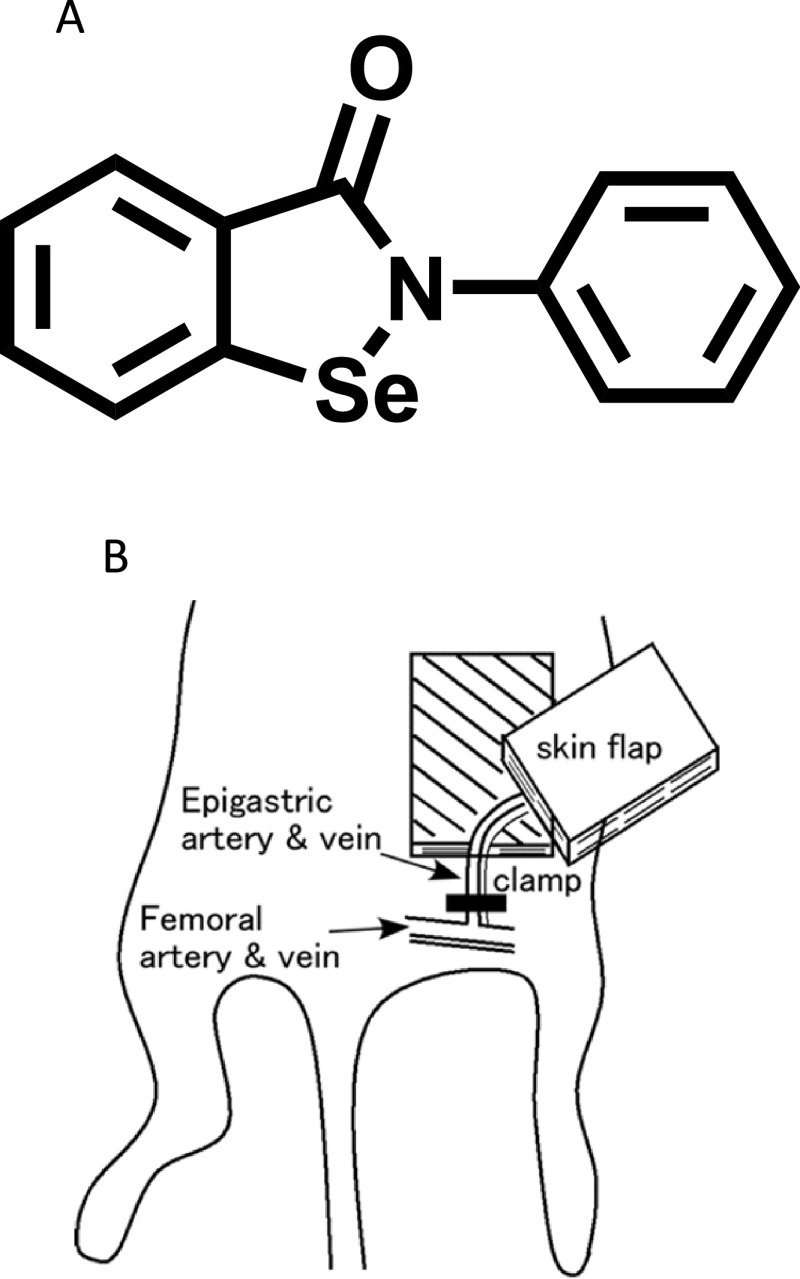 Protective Effect of Ebselen on Ischemia-reperfusion Injury in Epigastric Skin Flaps in Rats.