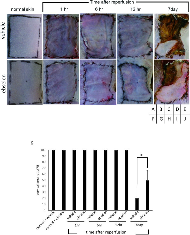 Protective Effect of Ebselen on Ischemia-reperfusion Injury in Epigastric Skin Flaps in Rats.