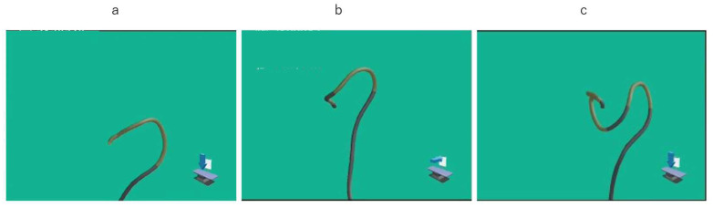 Investigation of the New Advantages of Colonoscope Insertion with an Endoscopic Position Detection Unit.