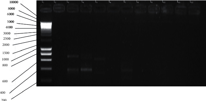 Molecular Assessment of Domain I of Apical Membrane Antigen I Gene in <i>Plasmodium falciparum</i>: Implications in <i>Plasmodium</i> Invasion, Taxonomy, Vaccine Development, and Drug Discovery.