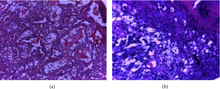 Prenatal Developmental Toxicity and Histopathological Changes of the Placenta Induced by <i>Syzygium guineense</i> Leaf Extract in Rats.