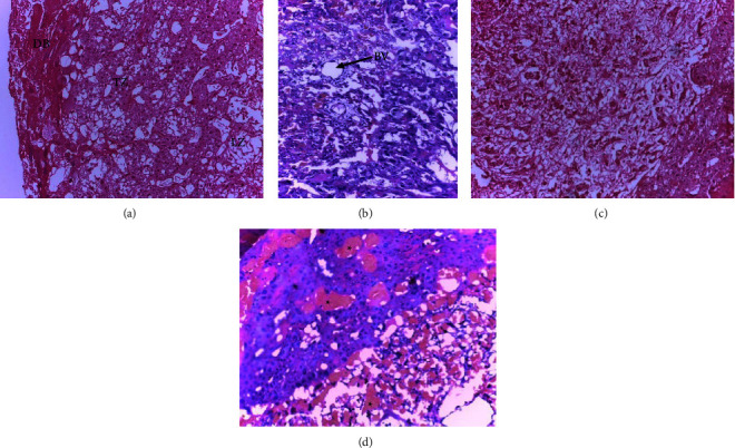 Prenatal Developmental Toxicity and Histopathological Changes of the Placenta Induced by <i>Syzygium guineense</i> Leaf Extract in Rats.