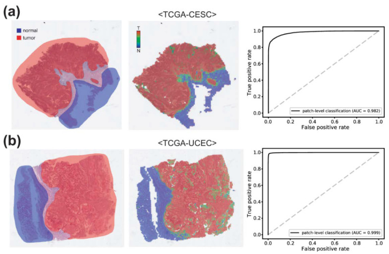 Deep Learning-Based Classification of Uterine Cervical and Endometrial Cancer Subtypes from Whole-Slide Histopathology Images.