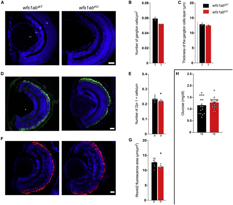 NCS1 overexpression restored mitochondrial activity and behavioral alterations in a zebrafish model of Wolfram syndrome.