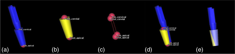 Accuracy of digital surgical guides for dental implants.