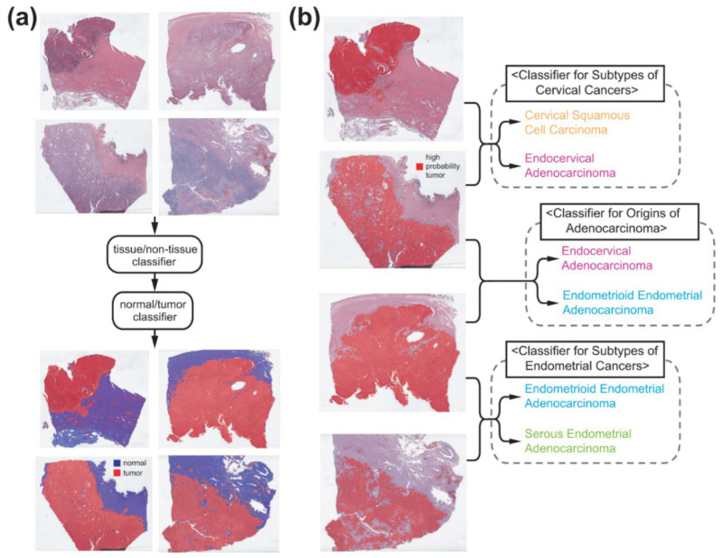 Deep Learning-Based Classification of Uterine Cervical and Endometrial Cancer Subtypes from Whole-Slide Histopathology Images.