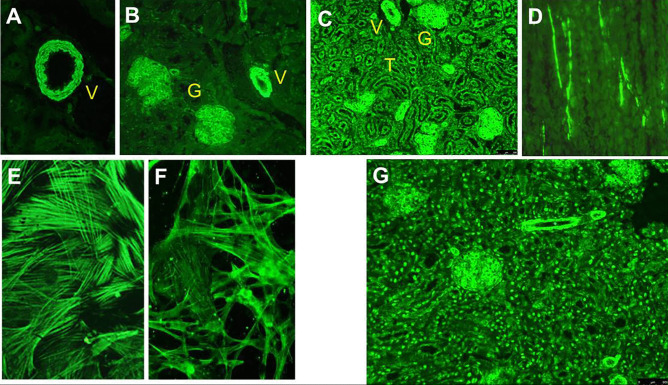 Autoimmune Hepatitis: Serum Autoantibodies in Clinical Practice.