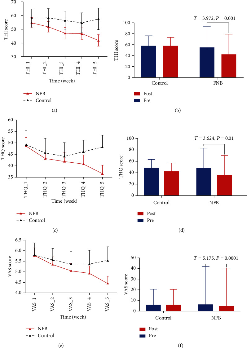 Self-Directed Neurofeedback Treatment for Subjective Tinnitus Patients Evaluated by Multimodal Functional Imaging.