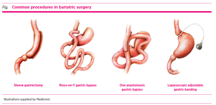 Bariatric surgery and medicines: from first principles to practice.