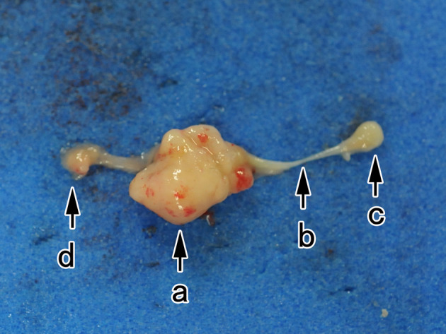 Primary epididymis squamous cell carcinoma in a CB6F1-Tg rasH2 mouse.