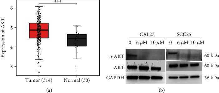 Chemoprevention of 4NQO-Induced Mouse Tongue Carcinogenesis by AKT Inhibitor through the MMP-9/RhoC Signaling Pathway and Autophagy.