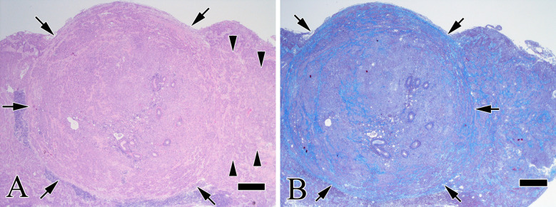 Primary epididymis squamous cell carcinoma in a CB6F1-Tg rasH2 mouse.