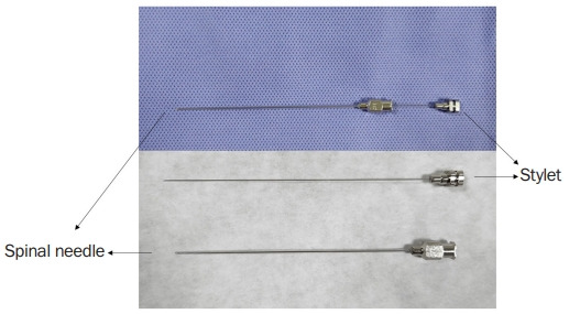Lumbar puncture: considerations, procedure, and complications.