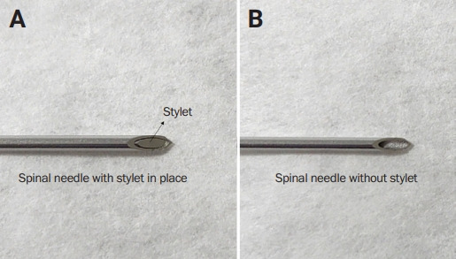 Lumbar puncture: considerations, procedure, and complications.