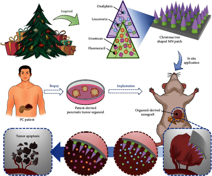 Christmas Tree-Shaped Microneedles as FOLFIRINOX Spatiotemporal Delivery System for Pancreatic Cancer Treatment.