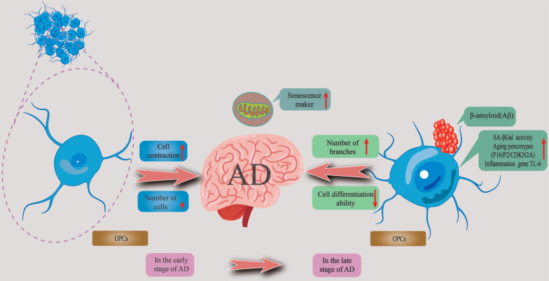 White Matter Damage in Alzheimer's Disease: Contribution of Oligodendrocytes.