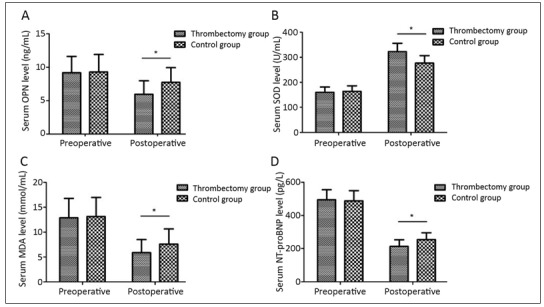 Efficacy of intravenous thrombolysis combined with mechanical stent interventional thrombectomy on acute ischemic stroke.