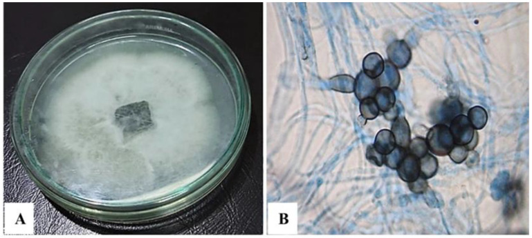 Morphological, Molecular and Metabolic Characterization of the Pigmented Fungus <i>Subramaniula asteroids</i>.