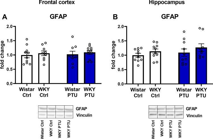 Changes in regulators of lipid metabolism in the brain: a study of animal models of depression and hypothyroidism.