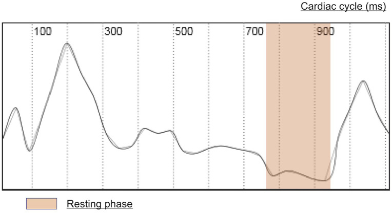 Neural network-based fully automated cardiac resting phase detection algorithm compared with manual detection in patients.