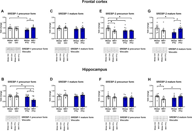 Changes in regulators of lipid metabolism in the brain: a study of animal models of depression and hypothyroidism.