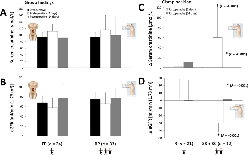 Retroperitoneal Compared to Transperitoneal Approach for Open Abdominal Aortic Aneurysm Repair Is Associated with Reduced Systemic Inflammation and Postoperative Morbidity.