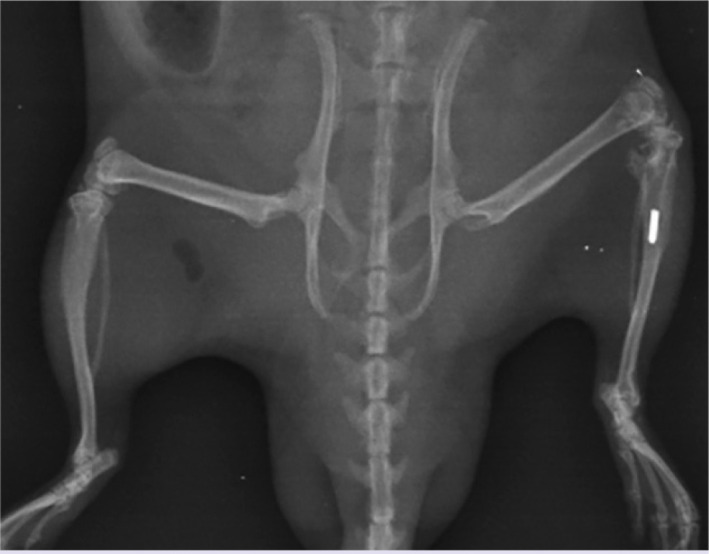 Rifaximine spacer application is not superior to local teicoplanin treatment in a rat model of osteomyelitis.