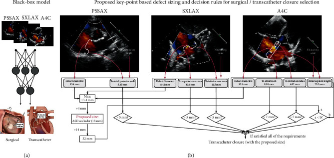 Assessment of Transcatheter or Surgical Closure of Atrial Septal Defect using Interpretable Deep Keypoint Stadiometry.
