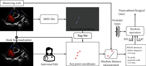 Assessment of Transcatheter or Surgical Closure of Atrial Septal Defect using Interpretable Deep Keypoint Stadiometry.