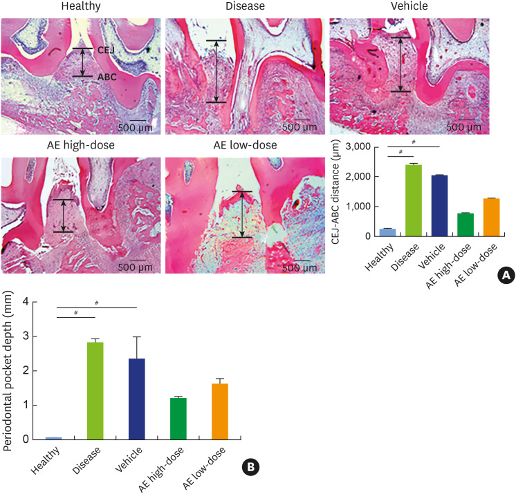 Effects of aloe-emodin on alveolar bone in <i>Porphyromonas gingivalis</i>-induced periodontitis rat model: a pilot study.