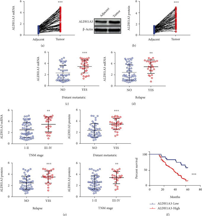 ALDH1A3-Linc00284 Axis Mediates the Invasion of Colorectal Cancer by Targeting TGF<i>β</i> Signaling via Sponging miR-361-5p.