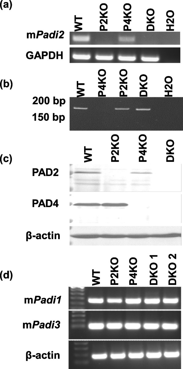 Delayed puberty, gonadotropin abnormalities and subfertility in male Padi2/Padi4 double knockout mice.