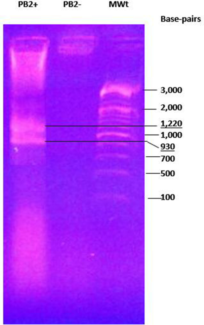 Characterization of novel bacteriocin PB2 and comprehensive detection of the pediocin gene ped-A1 from Pediococcus pentosaceus PB2 strain isolated from a sorghum-based fermented beverage in Nigeria