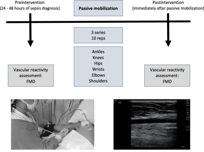 Early passive mobilization increases vascular reactivity response in critical patients with sepsis: a quasi-experimental study.