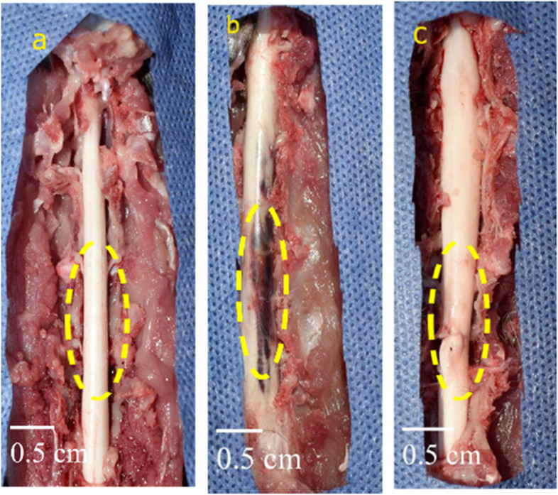 A novel cell-free intrathecal approach with PRP for the treatment of spinal cord multiple sclerosis in cats.