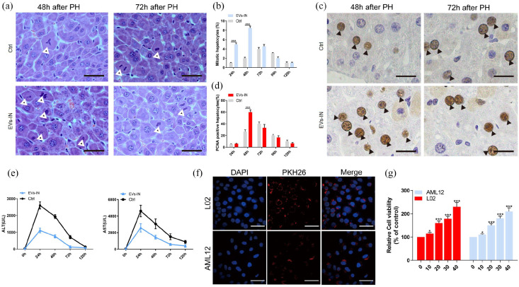 A new cell-free therapeutic strategy for liver regeneration: Human placental mesenchymal stem cell-derived extracellular vesicles.