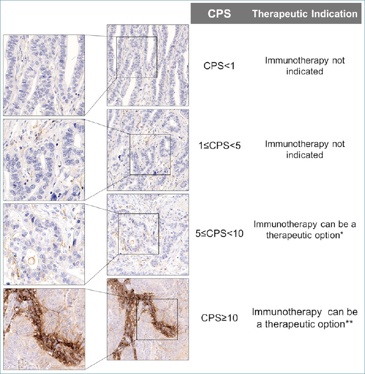 PD-L1 evaluation in the gastrointestinal tract: from biological rationale to its clinical application.