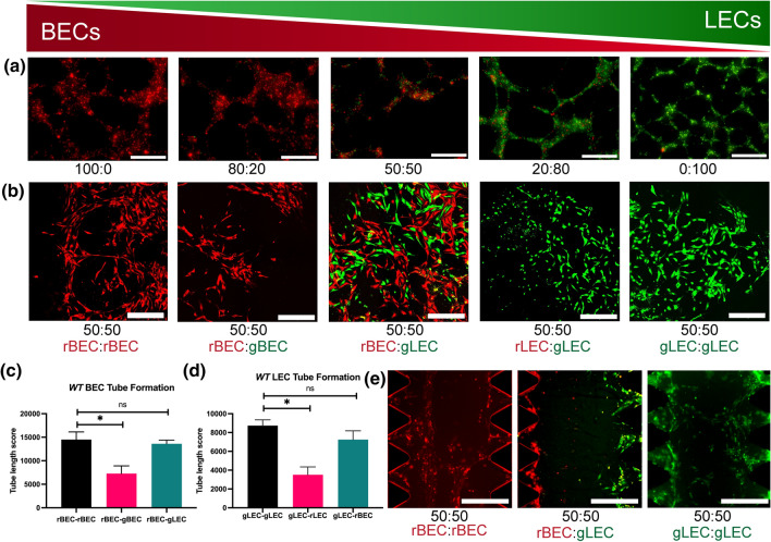 Podoplanin is Responsible for the Distinct Blood and Lymphatic Capillaries.