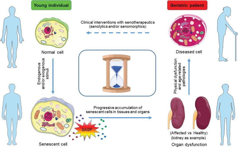 Targeting senescent cells for a healthier longevity: the roadmap for an era of global aging.