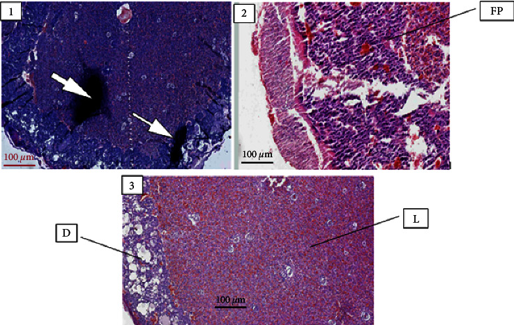 Teratogenic Evaluation of 80% Ethanol Extract of <i>Embelia schimperi</i> Vatke Fruits on Rat Embryo and Fetuses.