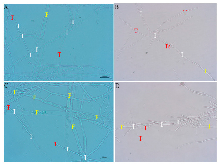 Antagonistic Effect of <i>Trichoderma longibrachiatum</i> (TL6 and TL13) on <i>Fusarium solani</i> and <i>Fusarium avenaceum</i> Causing Root Rot on Snow Pea Plants.