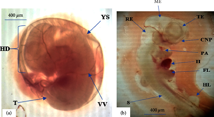 Teratogenic Evaluation of 80% Ethanol Extract of <i>Embelia schimperi</i> Vatke Fruits on Rat Embryo and Fetuses.