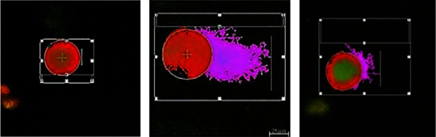 Assessment of Protective Effects of Carvacrol on Haloperidol-Induced Oxidative Stress and Genotoxicity in Human Peripheral Blood Lymphocytes.